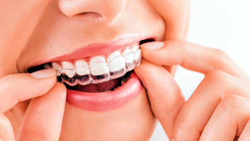 Cosmetic Dentistry at Dr. Dhanshree's Dental Clinic